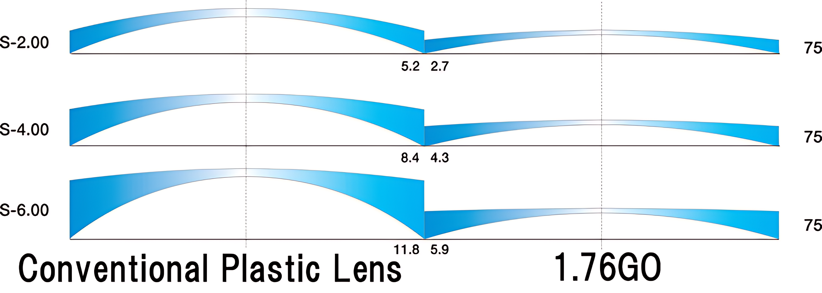 A graphic illustrating three conventional plastic lens profiles labeled S-2.00, S-4.00, and S-6.00. Each profile shows varying thickness, with the thinnest at S-2.00 and the thickest at S-6.00. On the right side of each lens profile, numerical values are indicated: 5.2 & 2.7 for S-2.00, 8.4 & 4.3 for S-4.00, and 11.8 & 5.9 for S-6.00. The background is titled "Conventional Plastic Lens" with the value "1.76G0" prominently displayed.