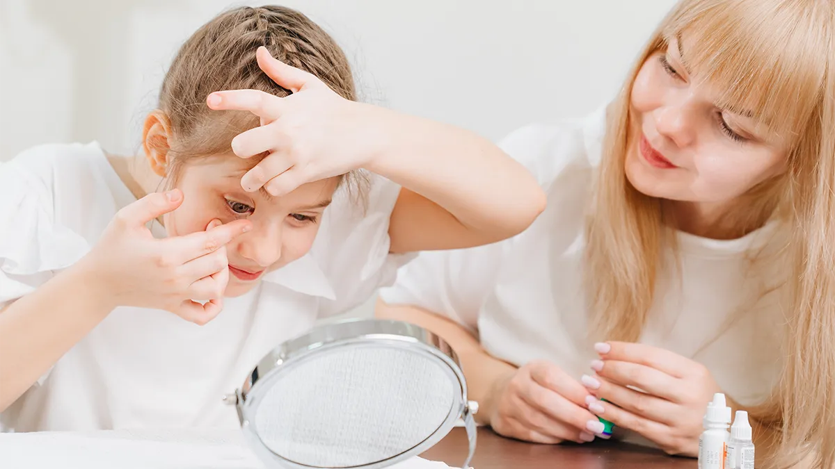Child having an orthokeratology lens inserted