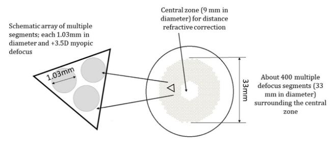 MiyoSmart honeycomb lens design